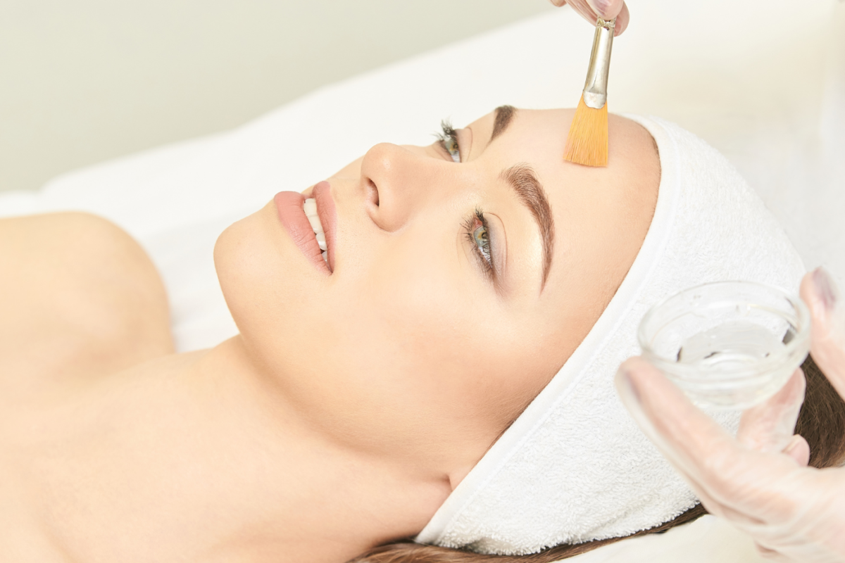 What is a Chemical Peel?