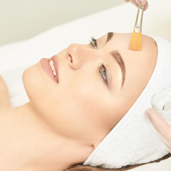 What is a Chemical Peel?