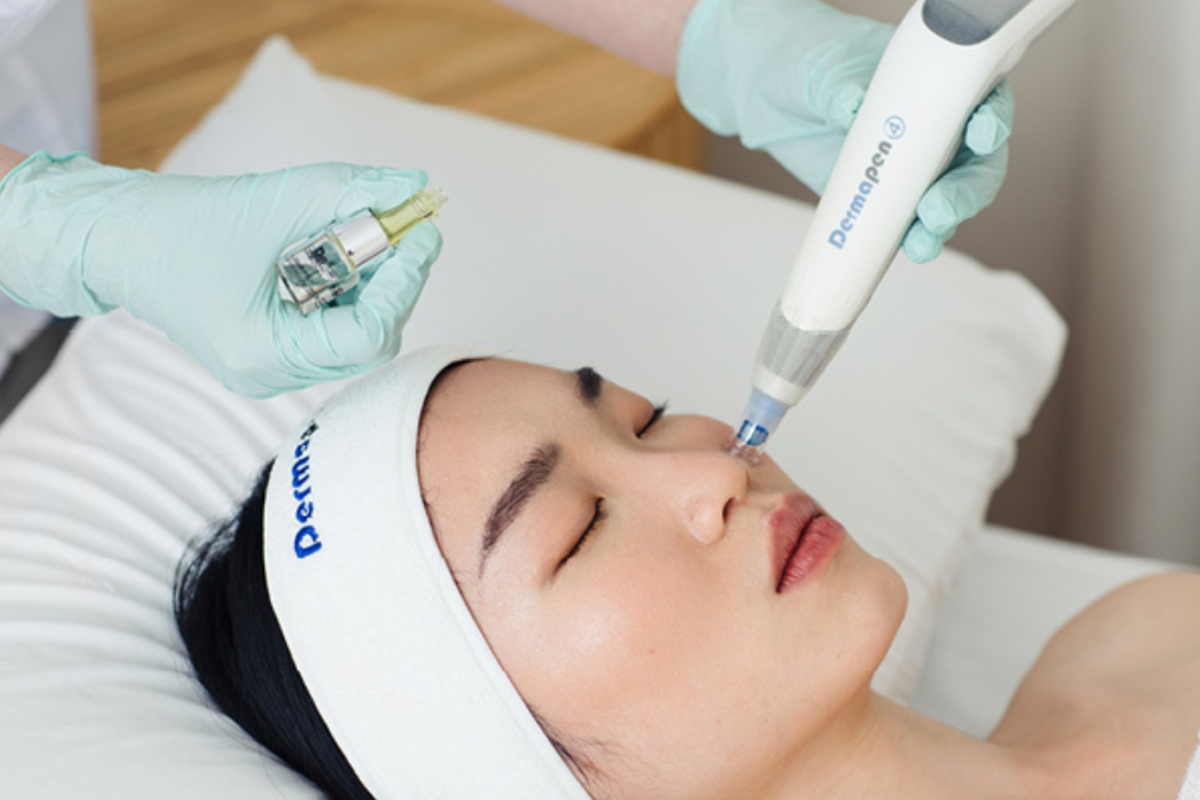 What Issues Can Medical Microneedling with Dermapen Fix?